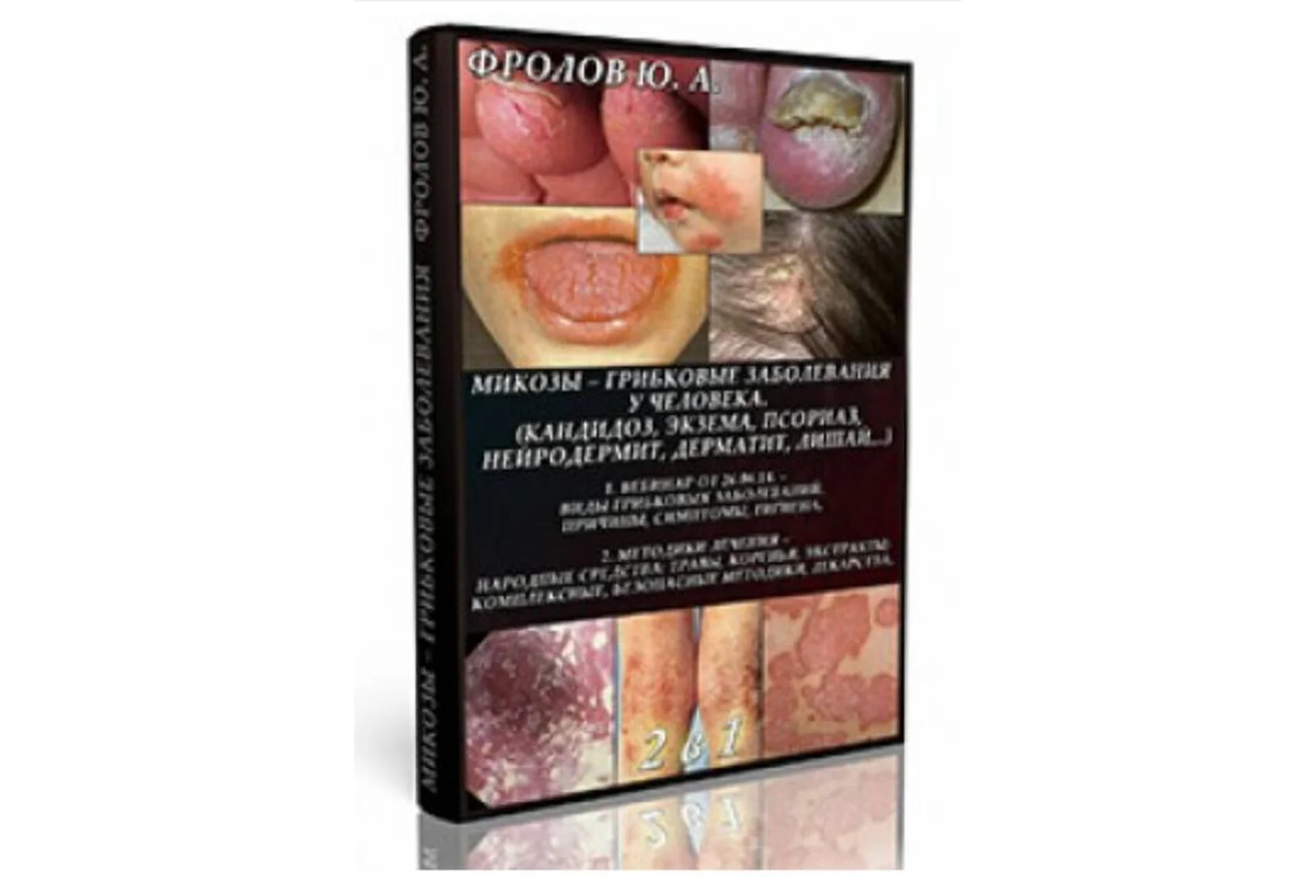 Методики излечения от грибковых заболеваний, инфопродукт №8 (Юрий Фролов), фото 1 из 1.