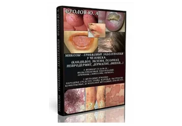 Методики излечения от грибковых заболеваний, инфопродукт №8 (Юрий Фролов)