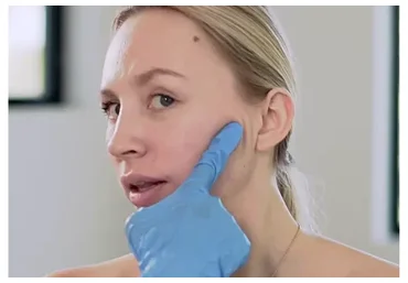 Буккальный само-массаж (Анастасия Талан)