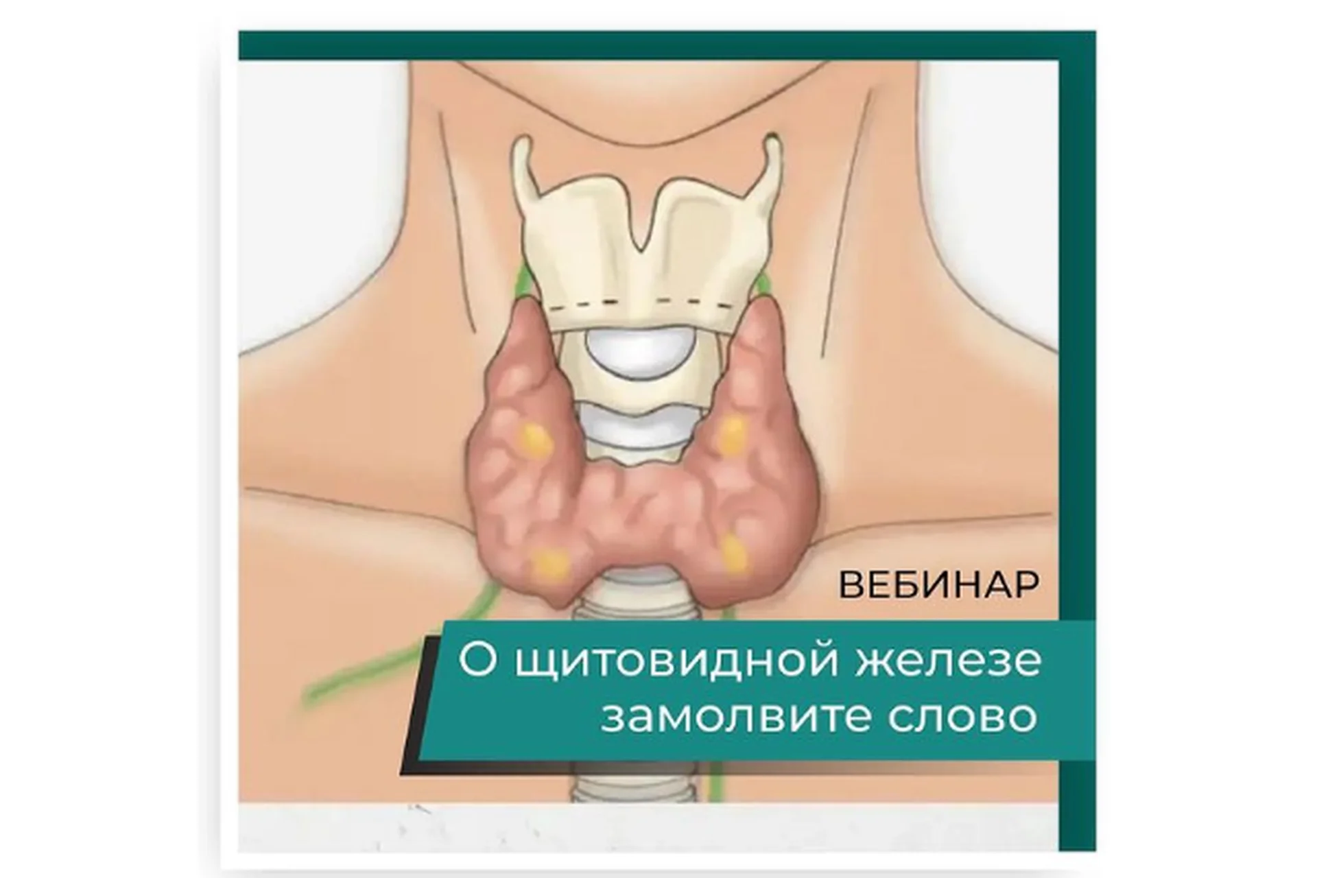 [detoxkafa] О щитовидной железе замолвите слово (Игорь Кауфман), фото 1 из 1.
