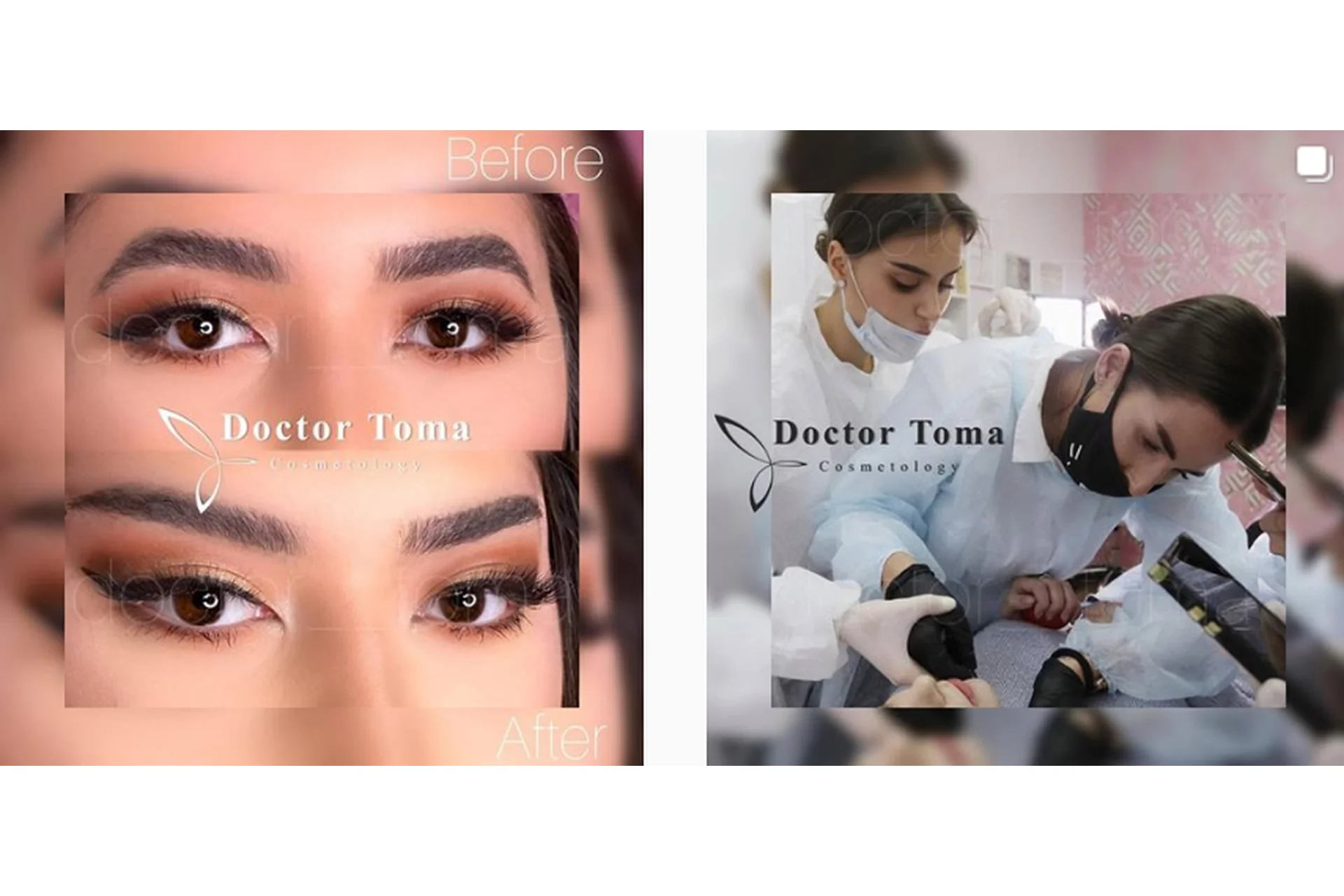 Контурная пластика лица и тела. День 2, Full Face (Тома Рязанцева), фото 1 из 1.