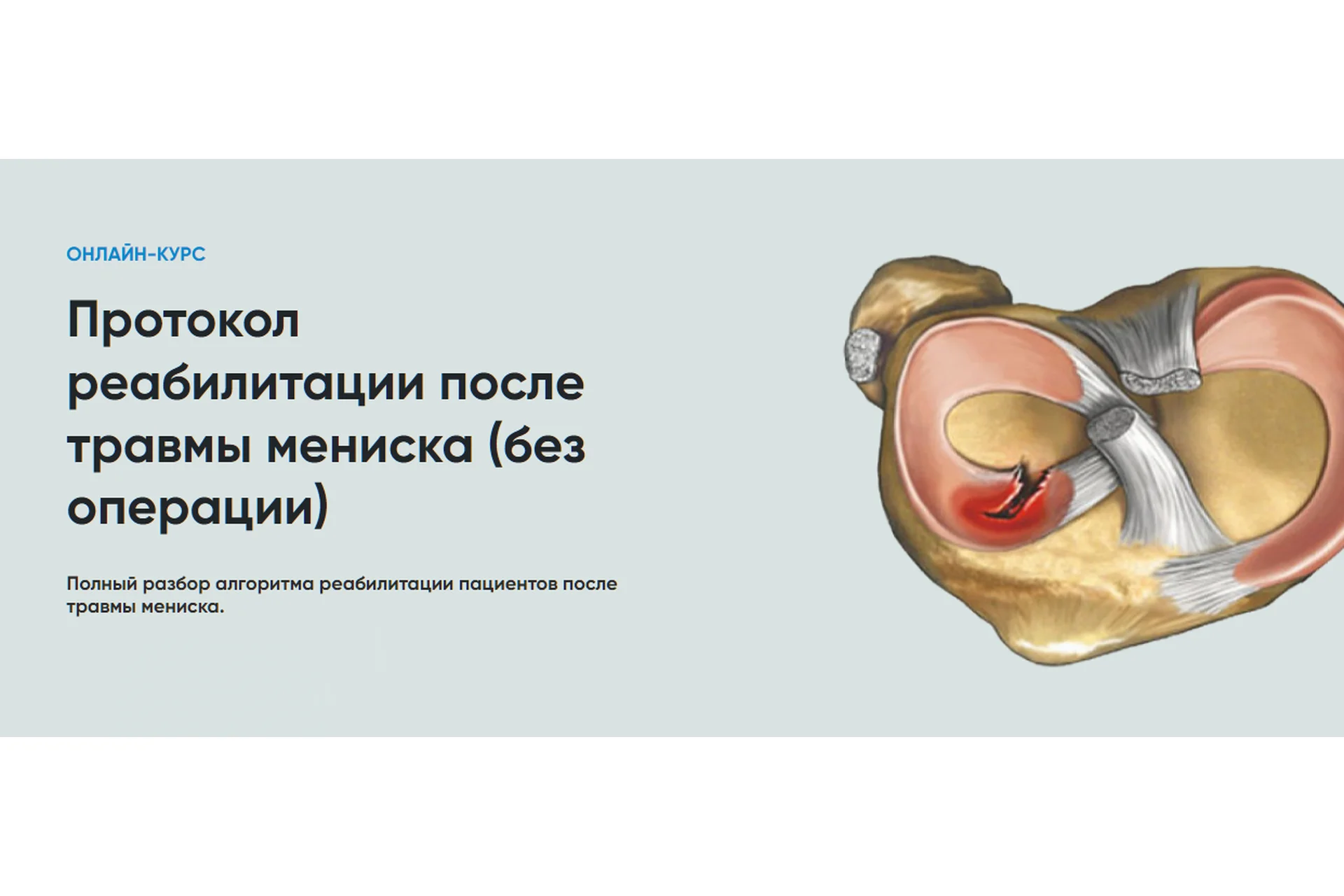 [Rehab Science] Протокол реабилитации после травмы мениска (Андрей Богатырев), фото 1 из 1.