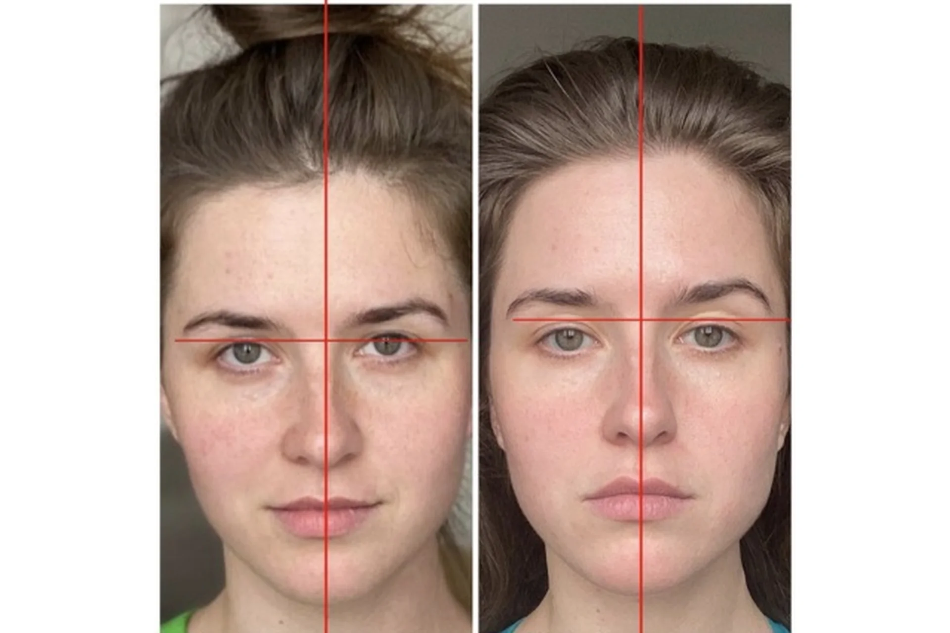 Самостоятельная коррекция черепа и челюсти (Кристина Андреева), фото 1 из 1.