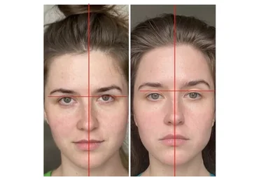 Самостоятельная коррекция черепа и челюсти (Кристина Андреева)