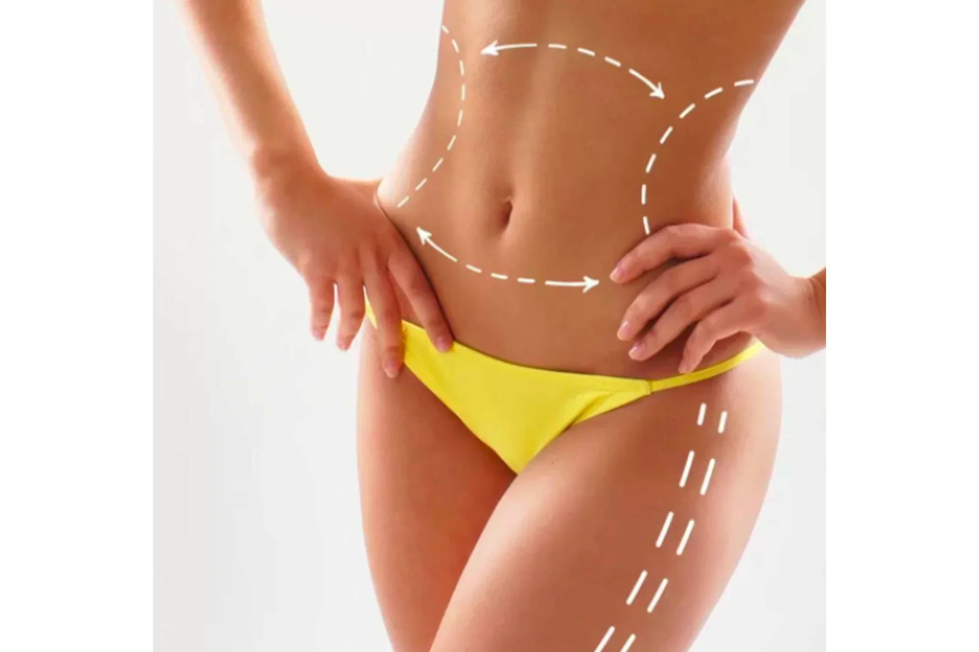 Ручная липопластика тела (Олег Тирский), фото 1 из 1.