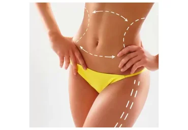 Ручная липопластика тела (Олег Тирский)