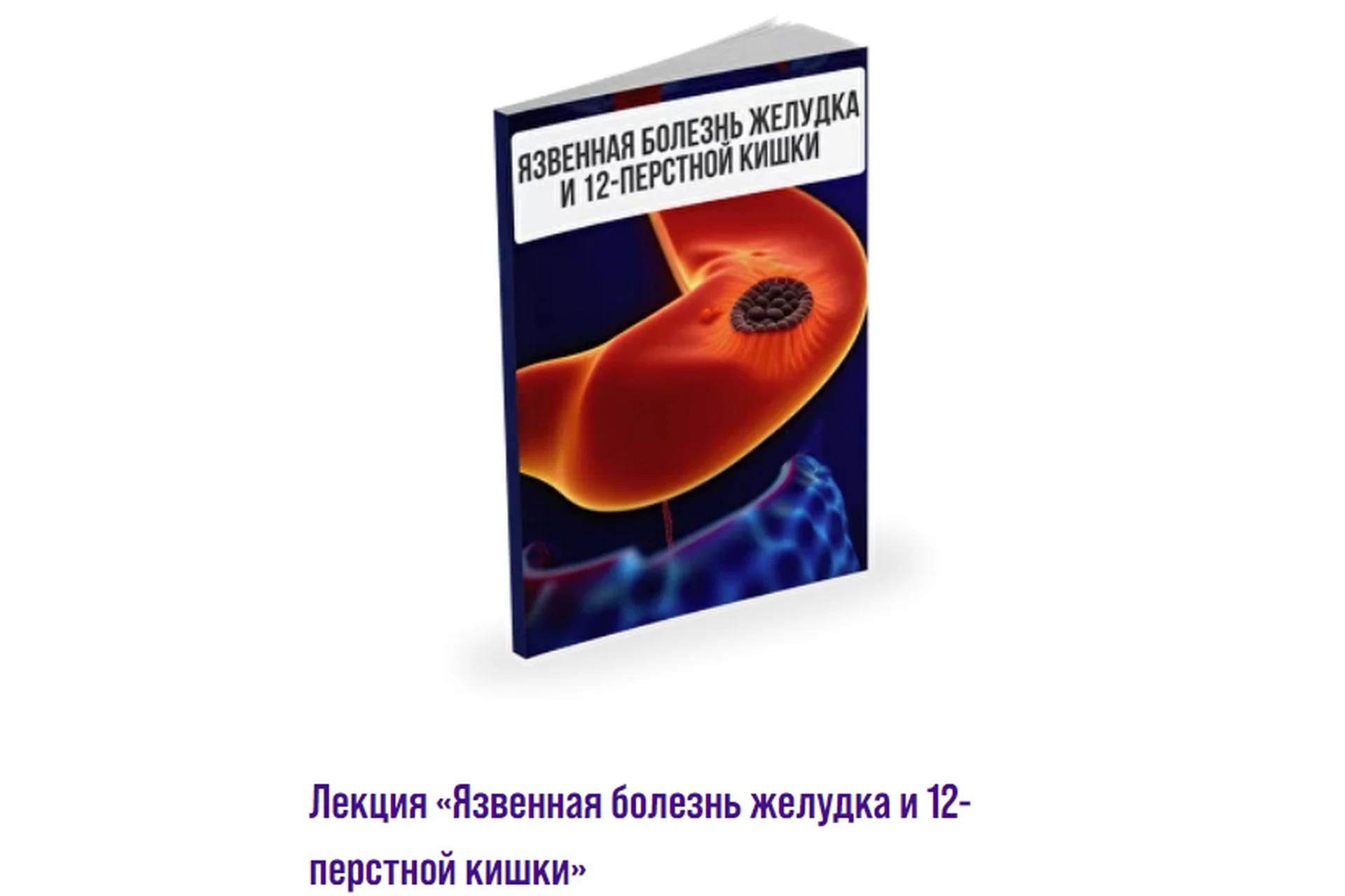 Язвенная болезнь желудка и 12-перстной кишки (Александр Павлов), фото 1 из 1.