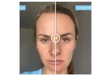 Hollywood — Секреты лиц с обложки (Белла Влади)