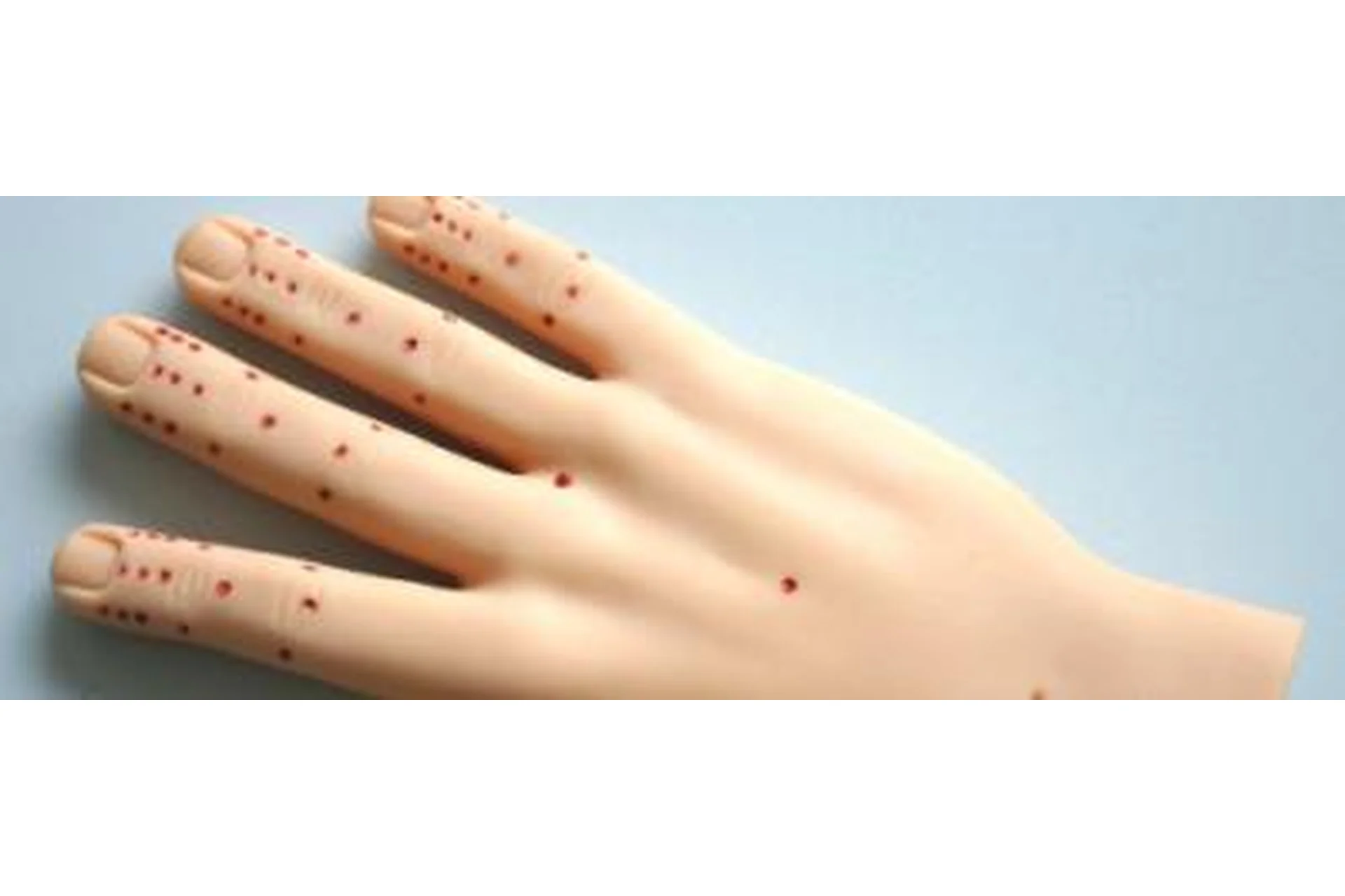 Акупунктура мастера Тонга. Вводный курс, уровень 1 (Ли Юн), фото 1 из 1.