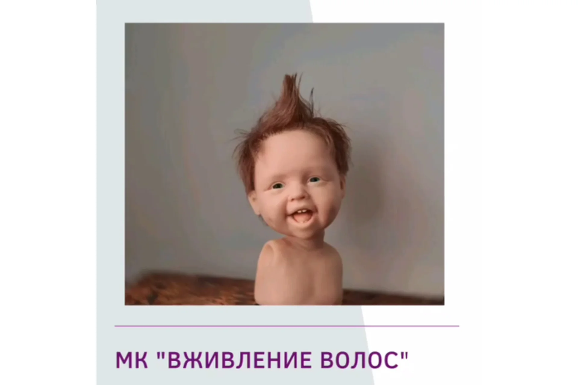 Вживление волос  (Галина Маковская), фото 1 из 1.