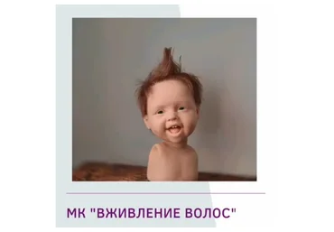 Вживление волос  (Галина Маковская)