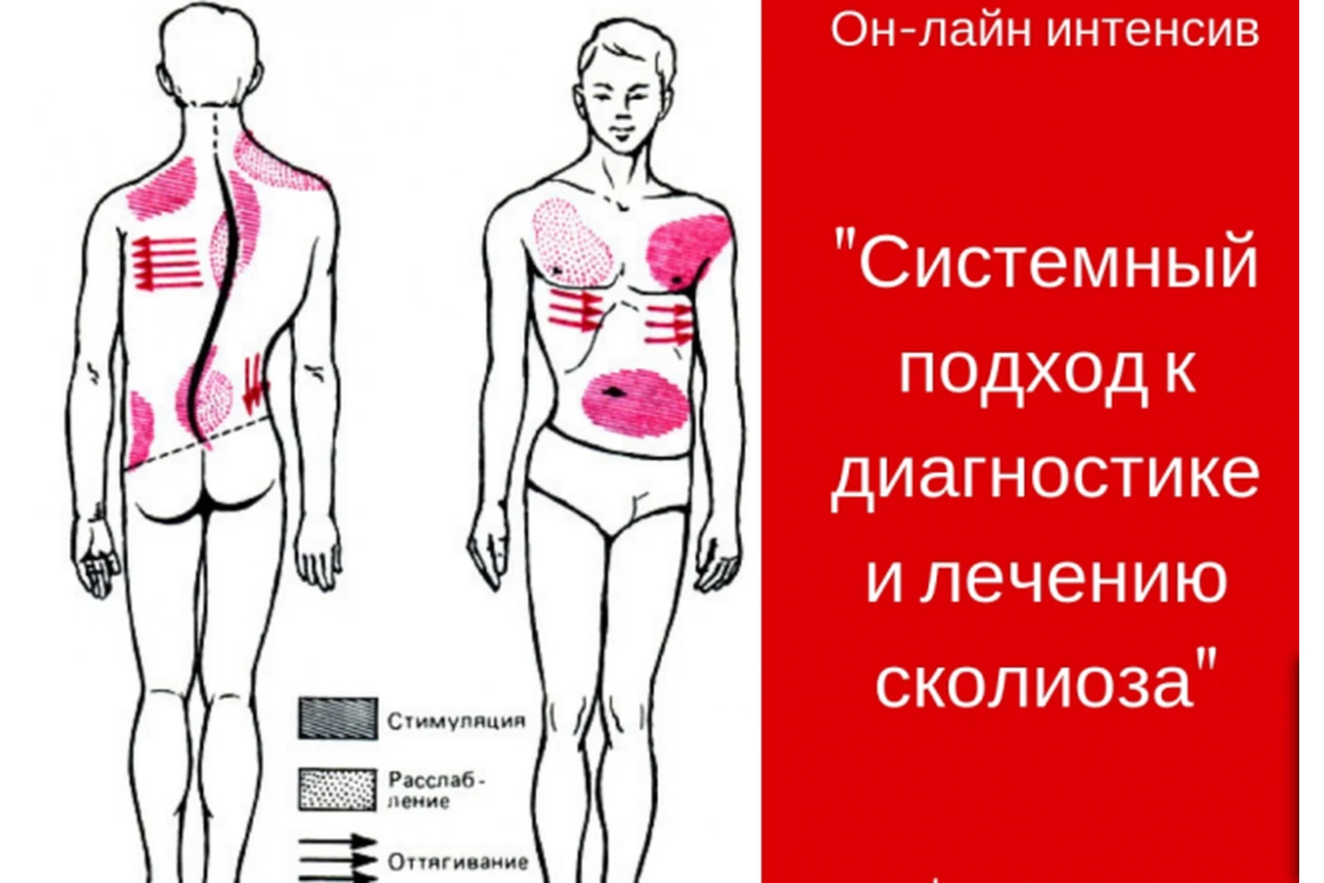 Системный подход к лечению сколиоза (Игорь Атрощенко), фото 1 из 1.