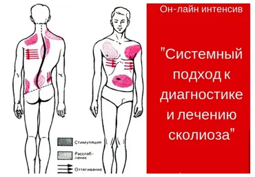 Системный подход к лечению сколиоза (Игорь Атрощенко)