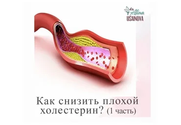 Как снизить плохой холестерин? 1 часть (Алина Усаинова)