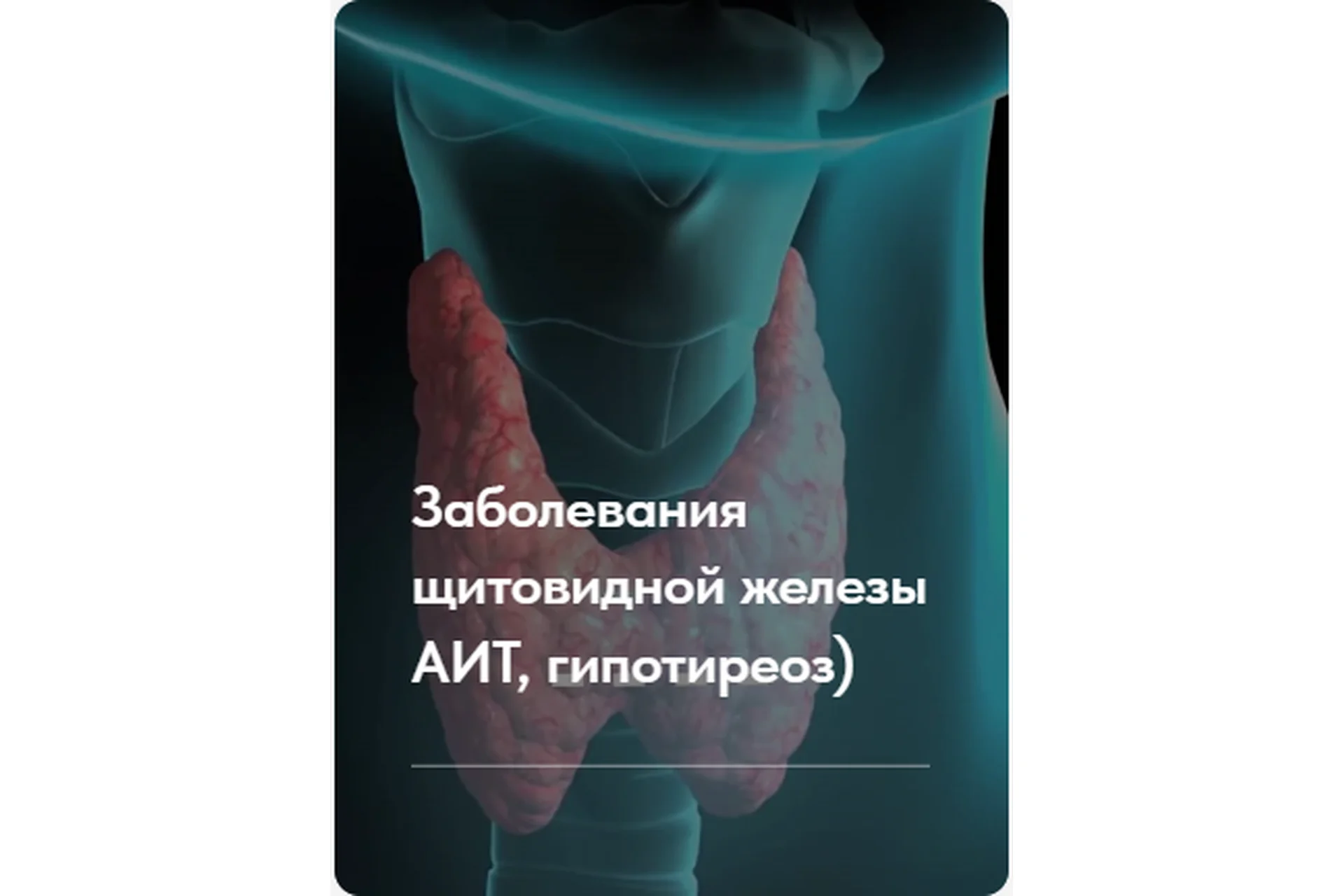 Лечебный протокол «Заболевания щитовидной железы». Тариф Без обратной связи (Елена Ержанова), фото 1 из 1.