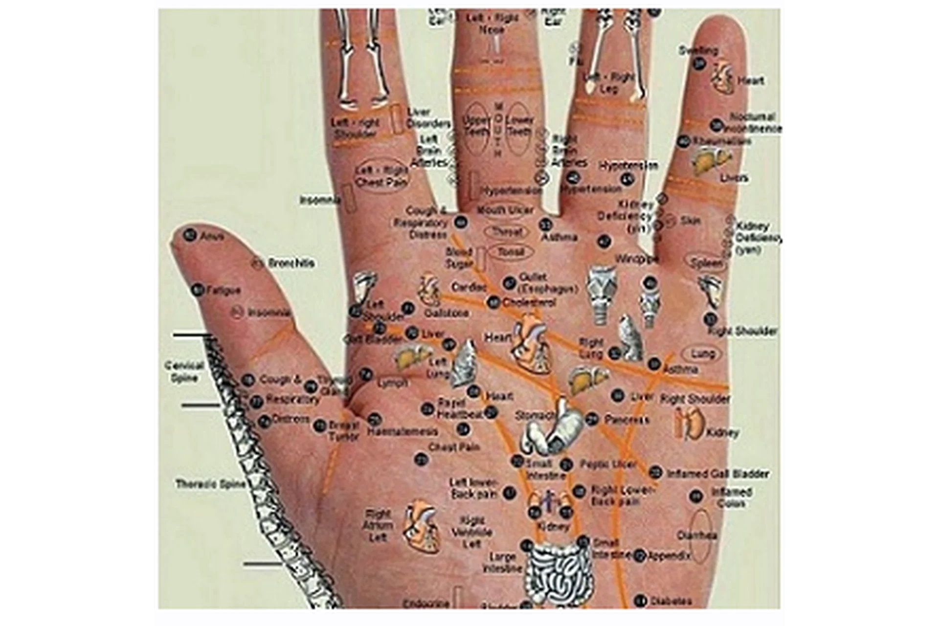 Вегетососудистая дистония (Ван Вэй), фото 1 из 1.