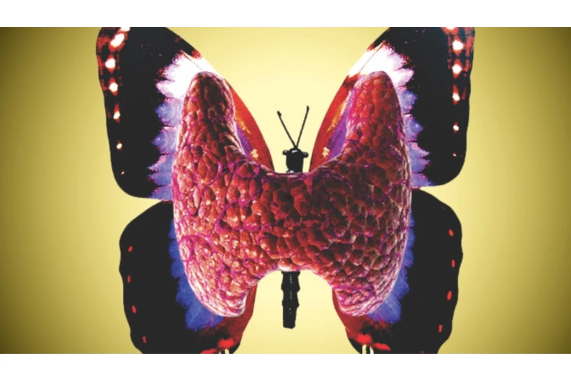 [Pro et Contra] Щитовидная железа, её роль в организме (Юлия Тишова), фото 1 из 1.