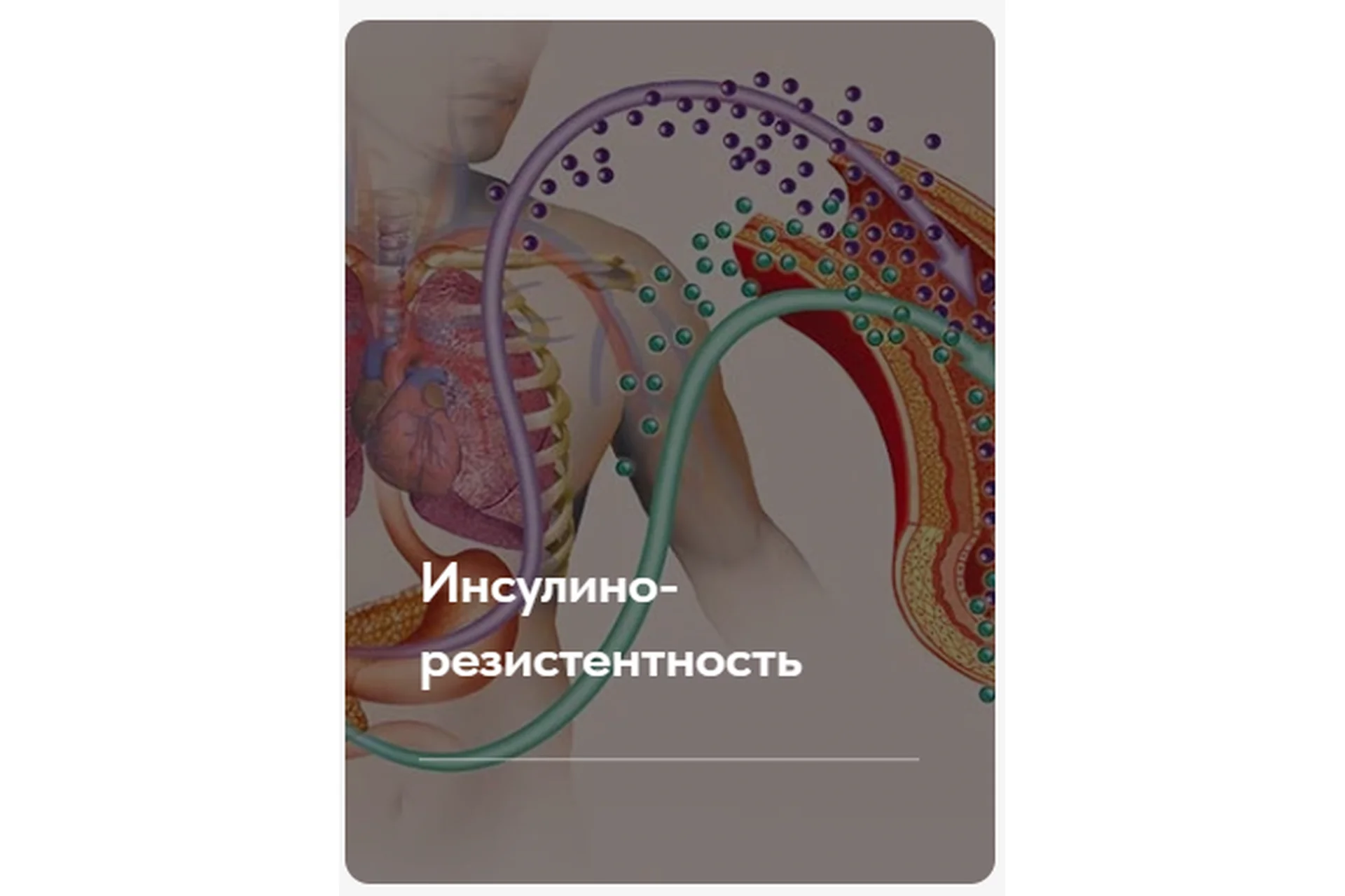 Лечебный протокол «Инсулинорезистентность». Тариф Без обратной связи (Елена Ержанова), фото 1 из 1.