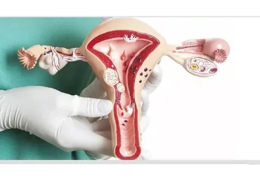 Миома матки. Бережное лечение (Ирина Жгарева)