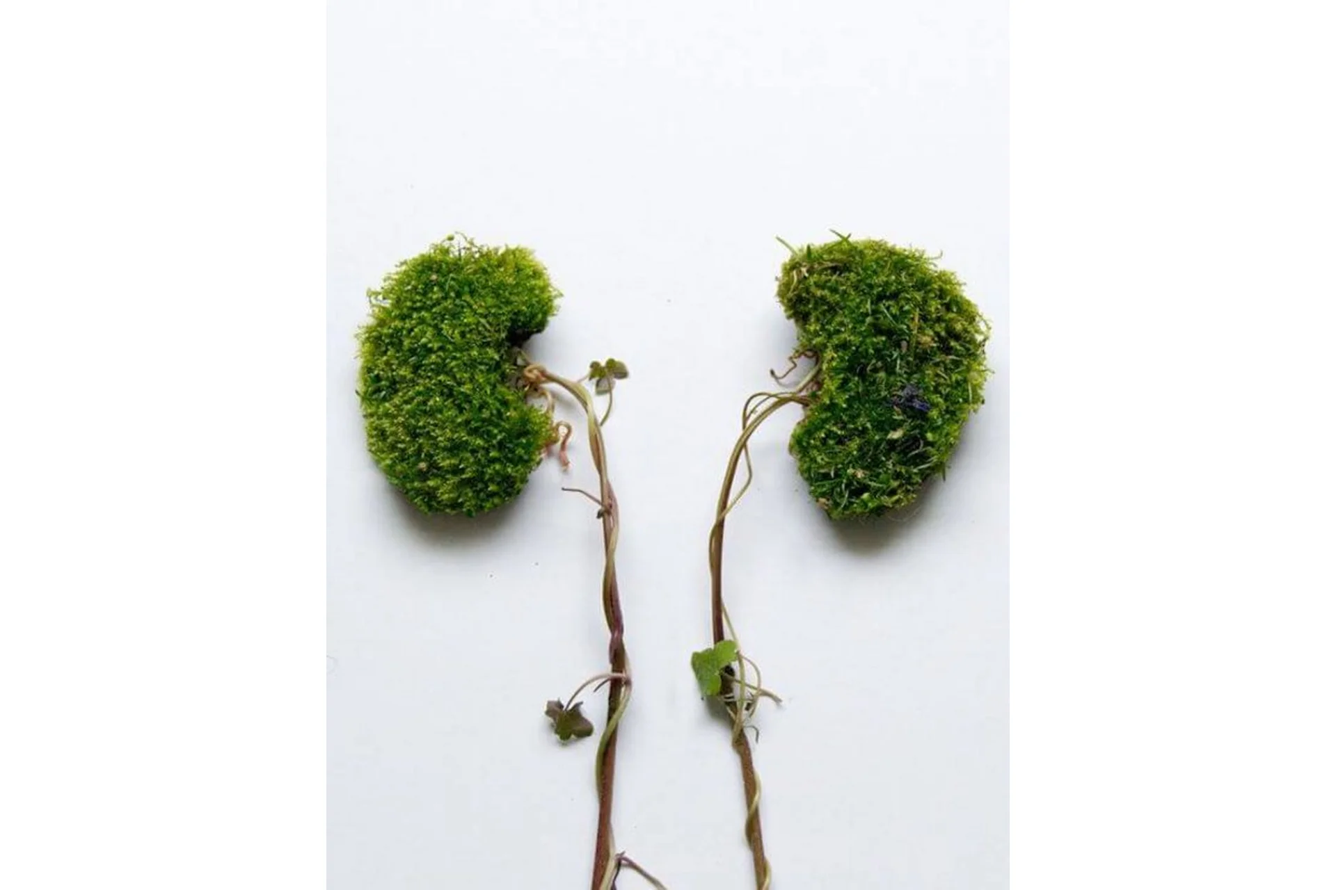 Здоровье почек и надпочечников: Два красивых боба (Ульвия Голденбрук), фото 1 из 1.