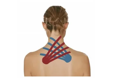 Тейпирование шейно-воротниковой зоны и спины (mavikatte)