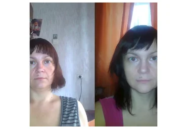 Естественное омоложение (Виктор Савинов)