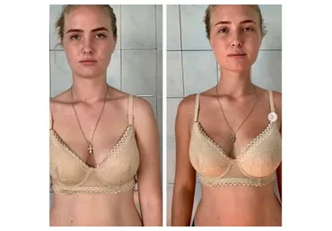 Восстановление молодости лица. 2.0 (Вера Красивая)