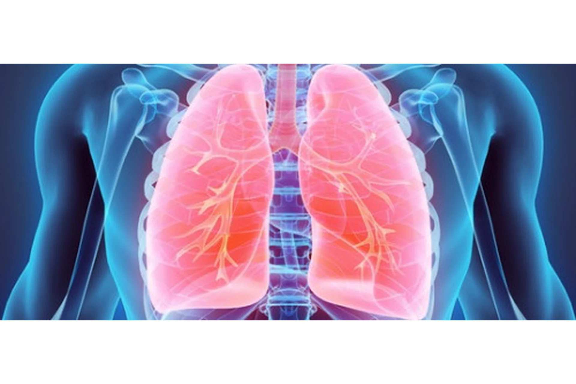 Коррекция легких (Юджиния Квант), фото 1 из 1.