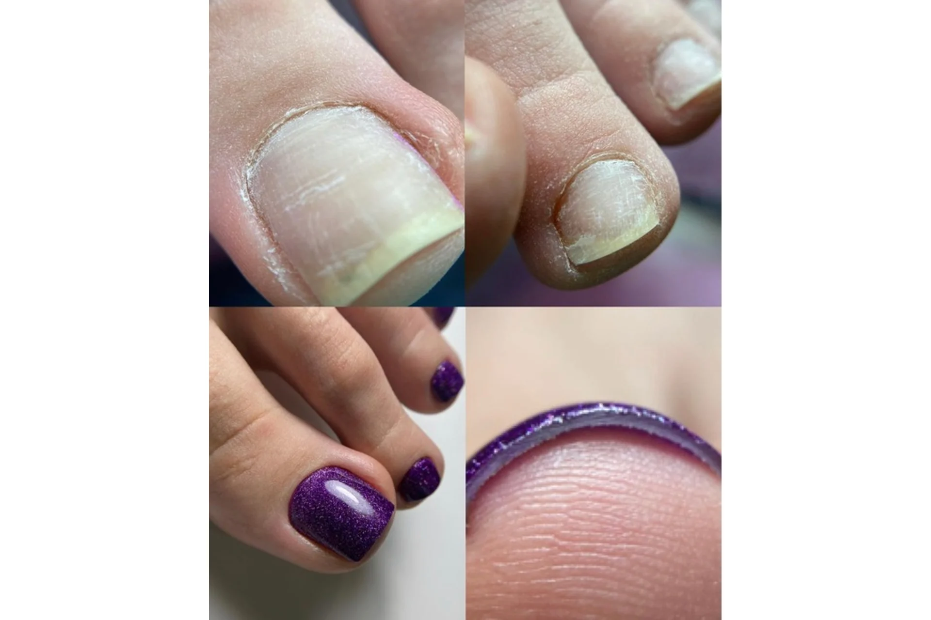 Культура педикюра. Эстетика. Тариф «Без обратной связи» (Анна Романова), фото 1 из 1.