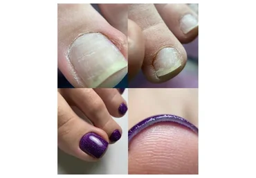 Культура педикюра. Эстетика. Тариф «Без обратной связи» (Анна Романова)