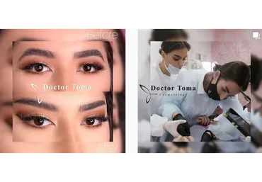 Контурная пластика лица и тела. День 1, аугментация губ (Тома Рязанцева)