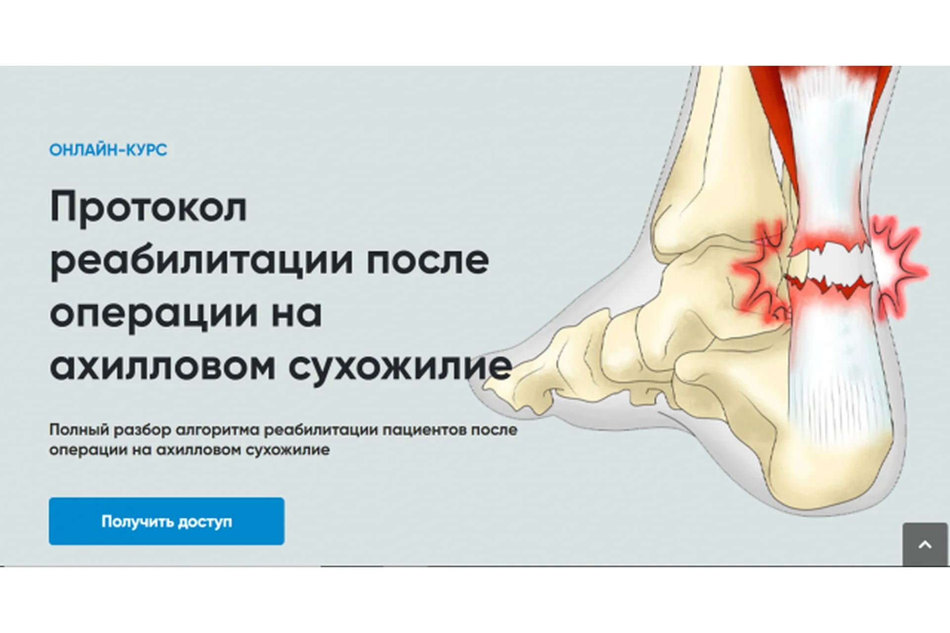[rehab science] Протокол реабилитации после операции на ахилловом сухожилии (Андрей Богатырев), фото 1 из 1.