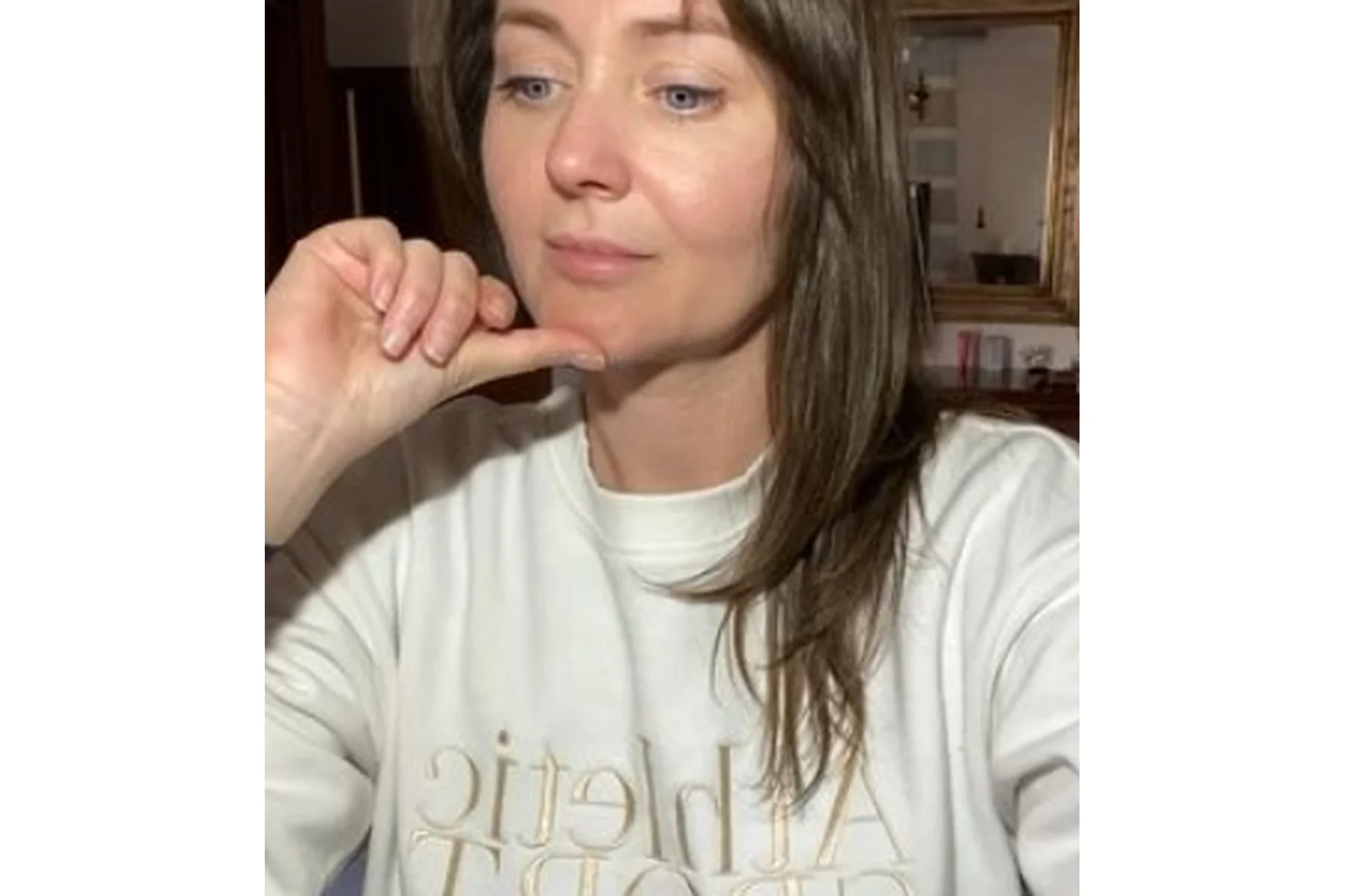 Дисплазия соединительной ткани (Оксана Терехова), фото 1 из 1.