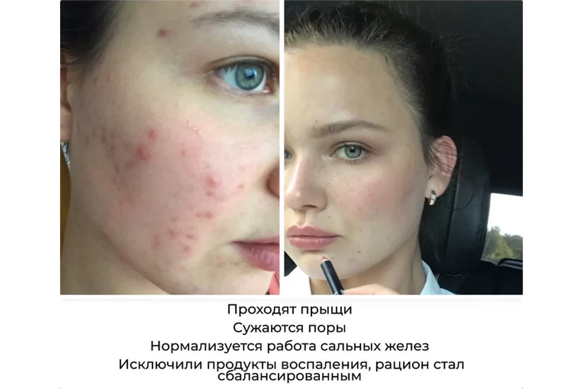 4 шага к красивой коже (Ксения Чёрная), фото 1 из 1.