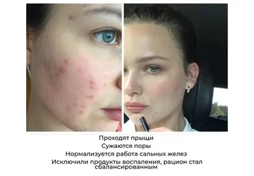 4 шага к красивой коже (Ксения Чёрная)