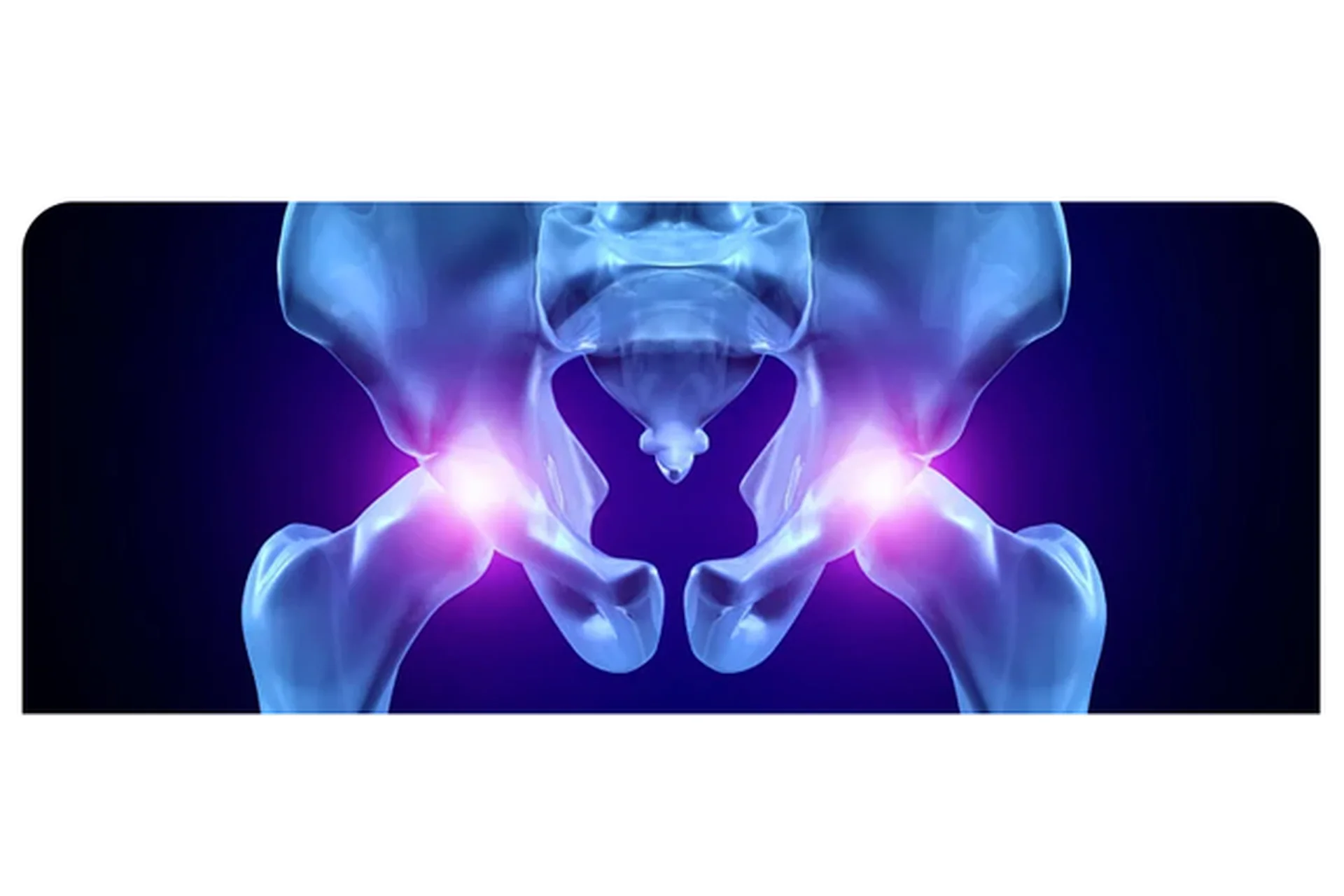 Цикл лекций: Тазобедренный сустав. Лекция 2 (Антон Епифанов), фото 1 из 1.