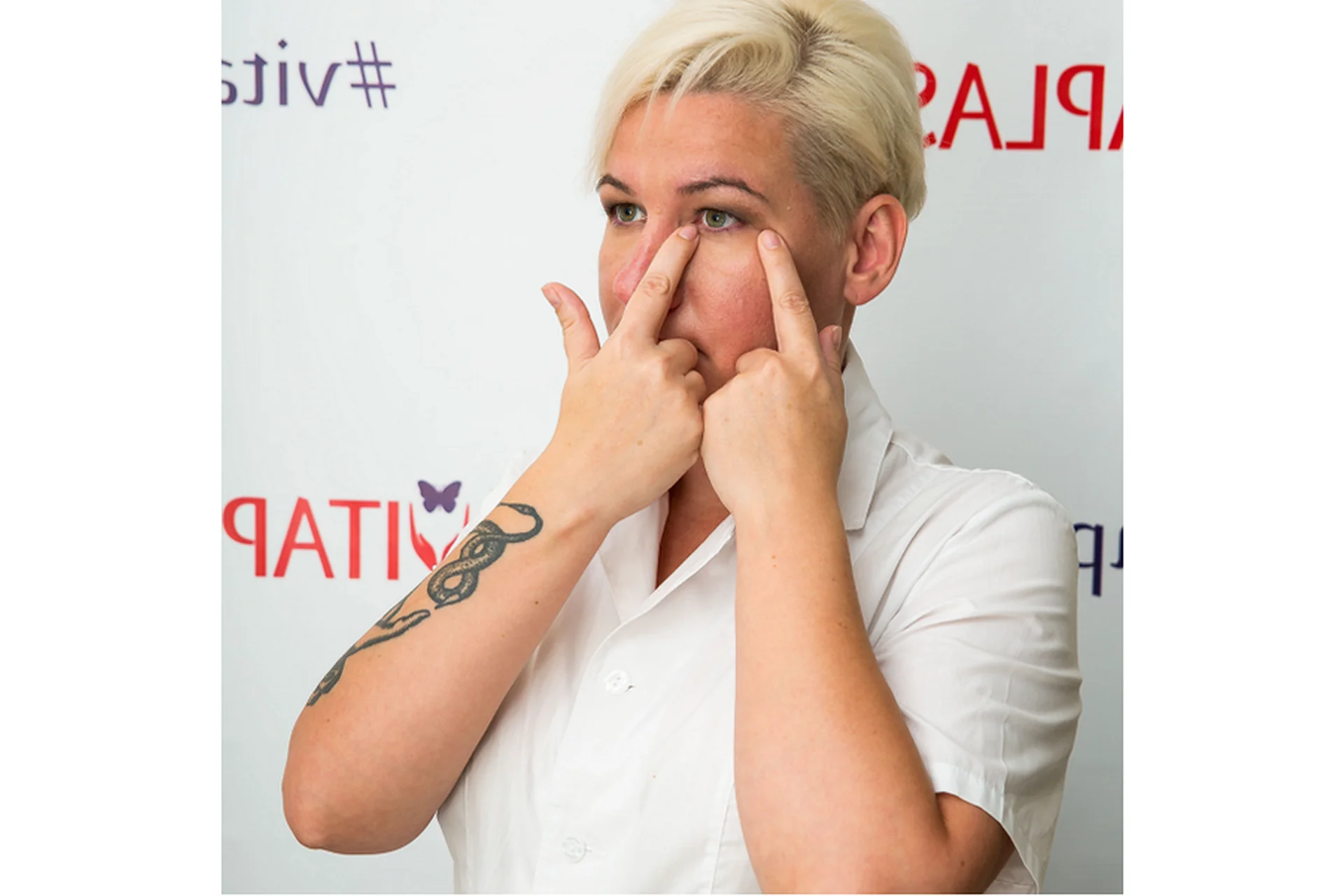 Витапластика для глаз (Надежда Басюбина), фото 1 из 1.