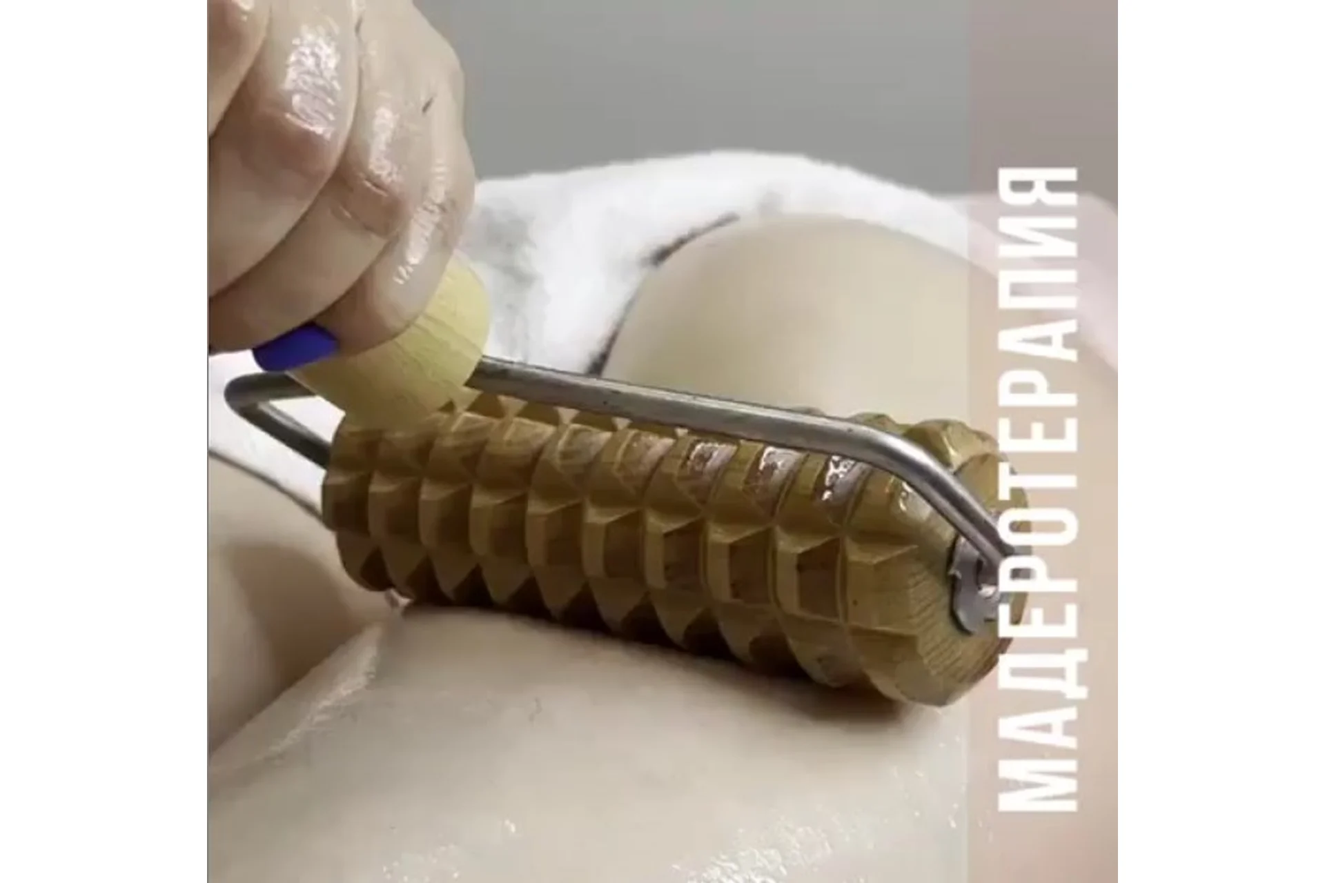 Медовая мадеротерапия тела (skalka_krd), фото 1 из 1.