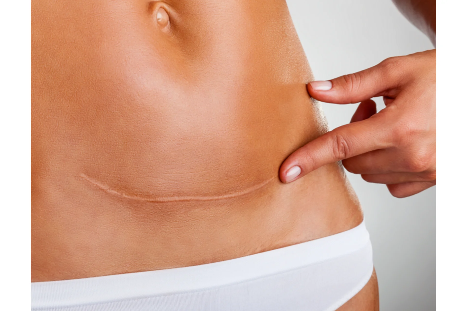 Работа с рубцами с помощью кинезио и кросс тейпирования (Валентин Гайт), фото 1 из 1.