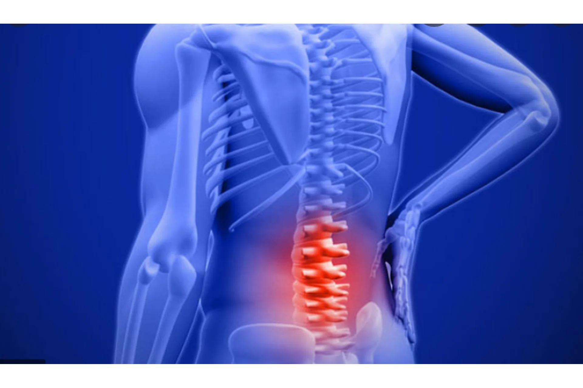 Восстановление поясничного отдела и крестца при протрузии и грыжи (Надежда Колесникова), фото 1 из 1.