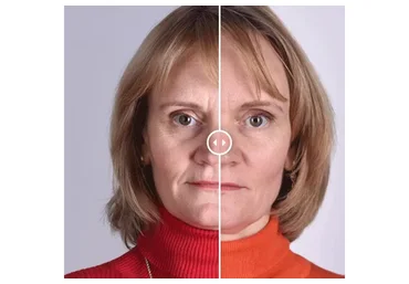 [Школа Фейсбилдинга Евгении Баглык] Фейс-интенсив (Евгения Баглык)