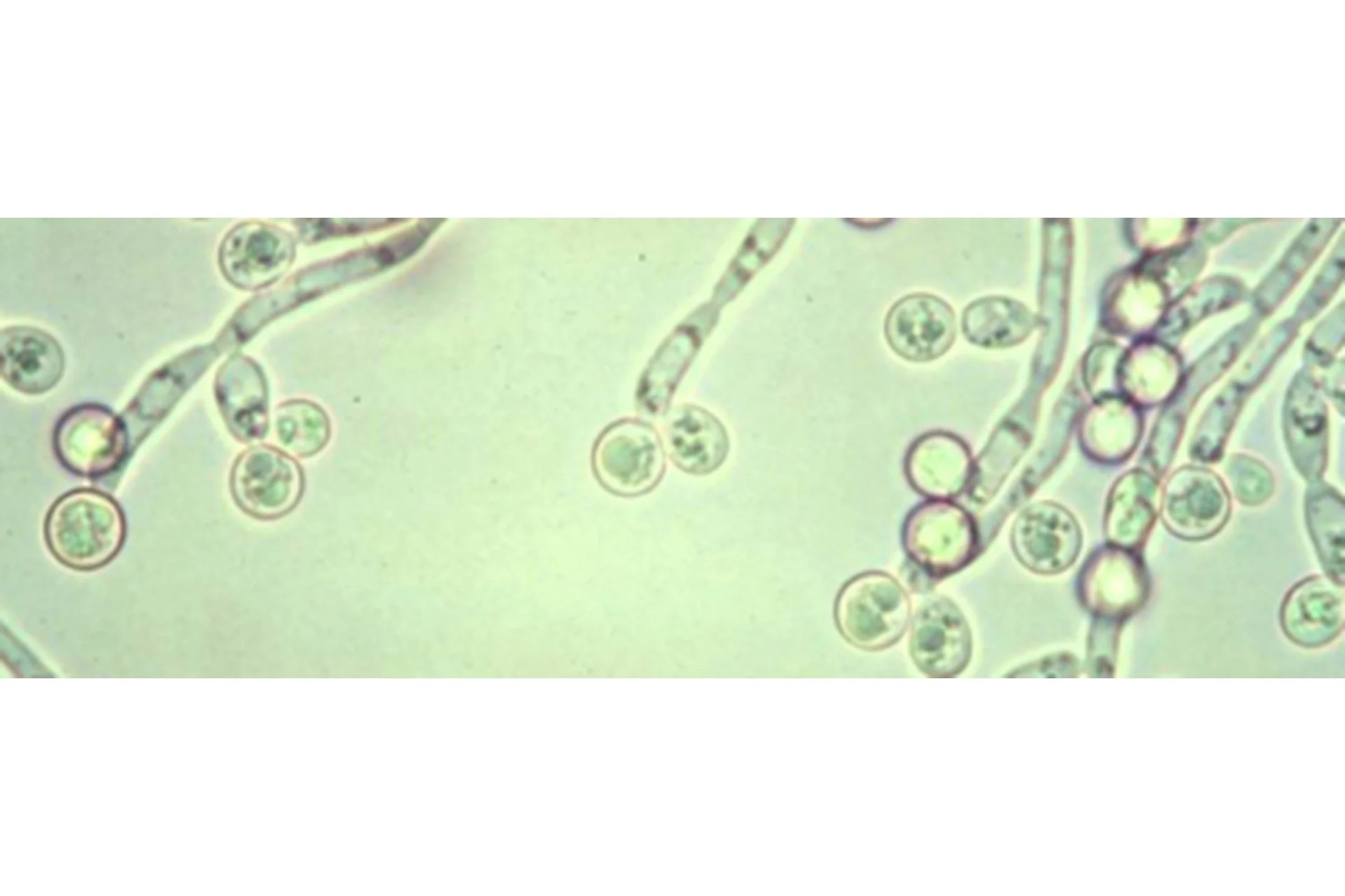 Грибы Candida — вор здоровья, фото 1 из 1.