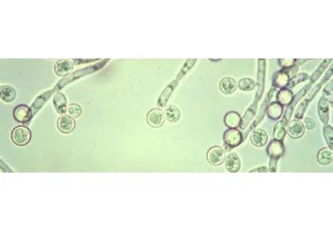 Грибы Candida — вор здоровья