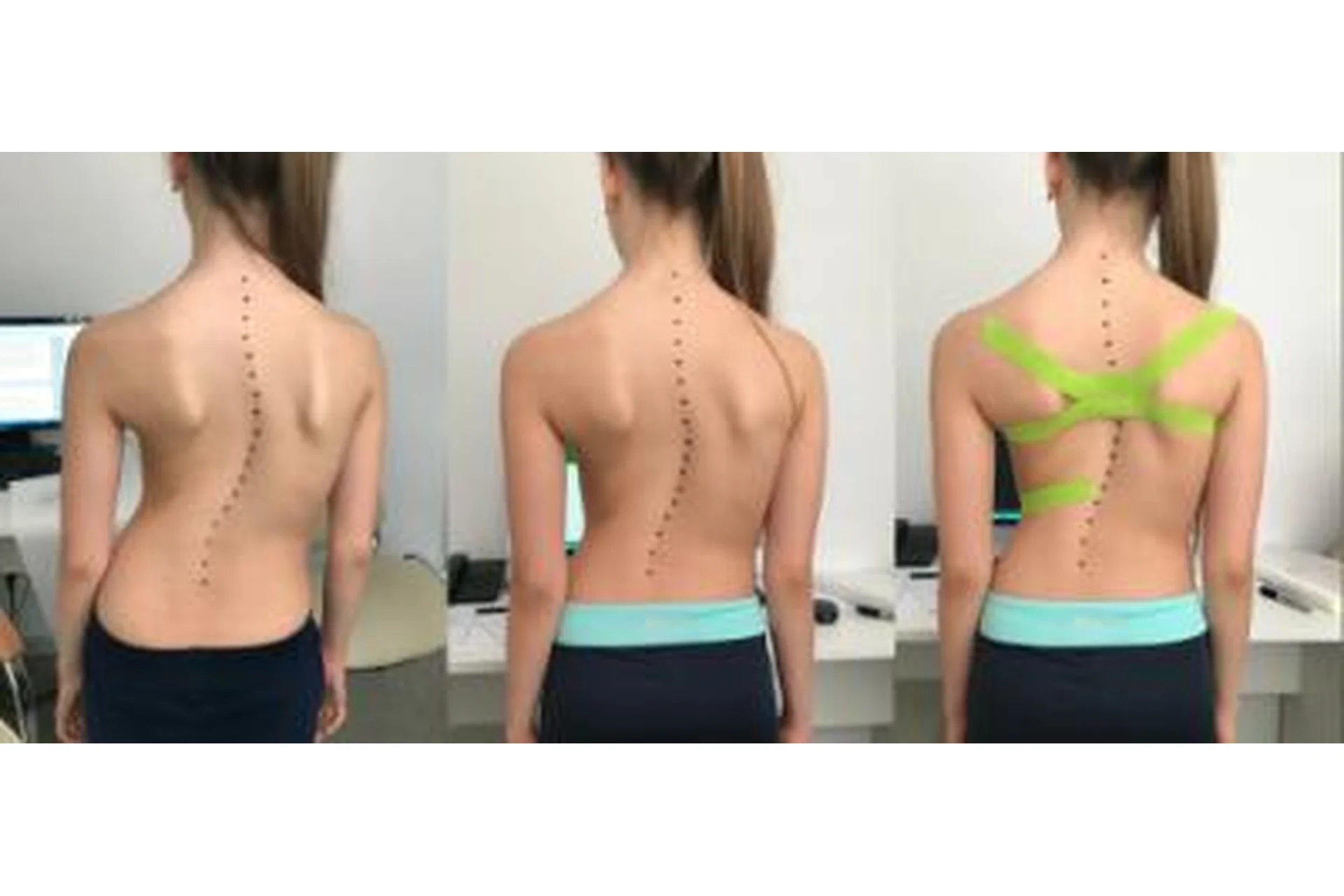 [Центр Практика] Про сколиоз (Елена Волкова), фото 1 из 1.