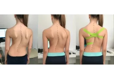 [Центр Практика] Про сколиоз (Елена Волкова)