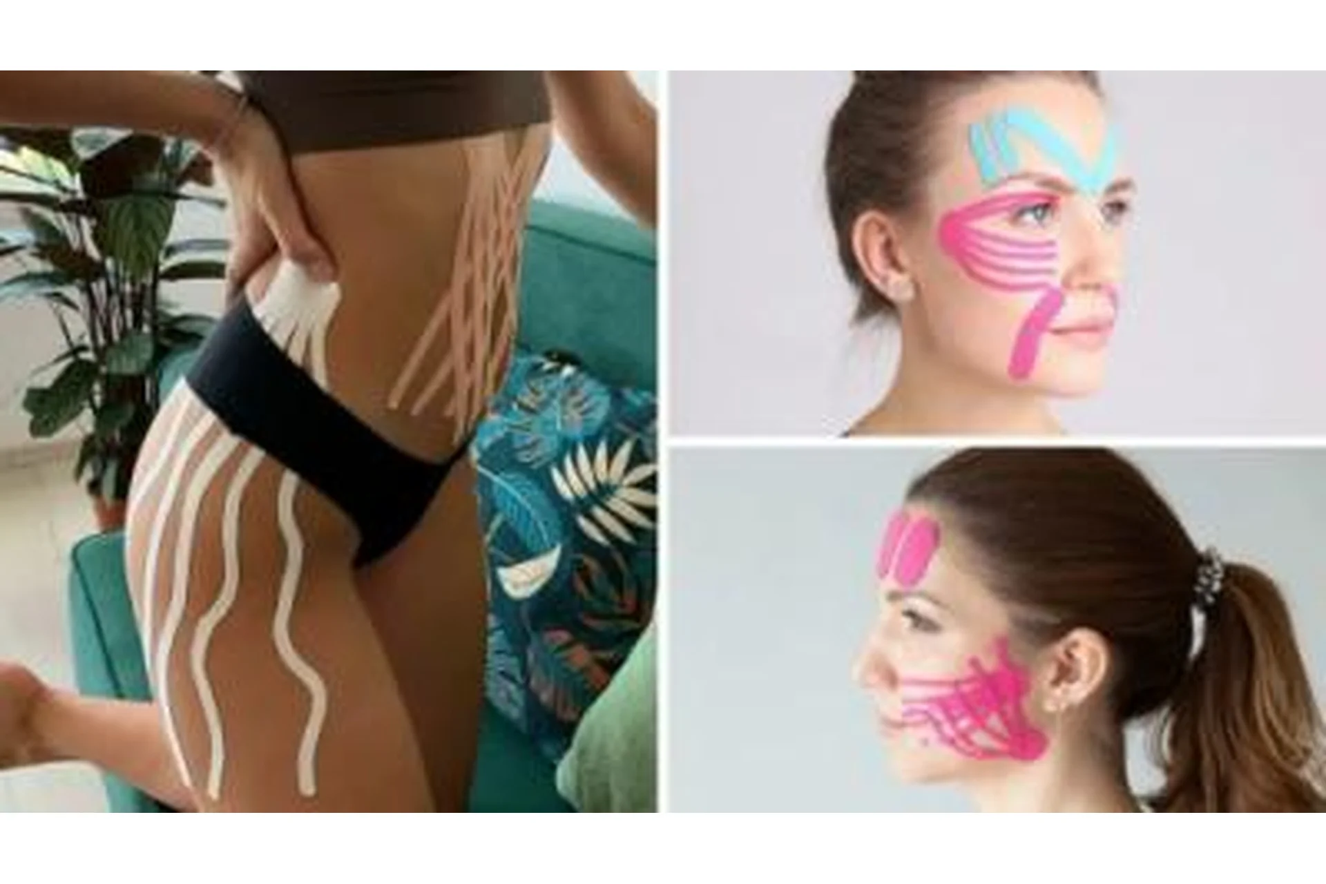 Эстетическое тейпирование при дисфункции челюстно-лицевого сустава (Екатерина Шубина), фото 1 из 1.