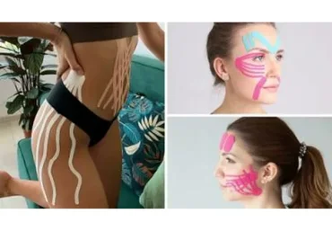 Эстетическое тейпирование при дисфункции челюстно-лицевого сустава (Екатерина Шубина)