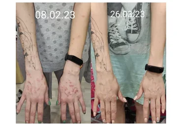 Легендарный прочистон (Алёна Ковальчук)