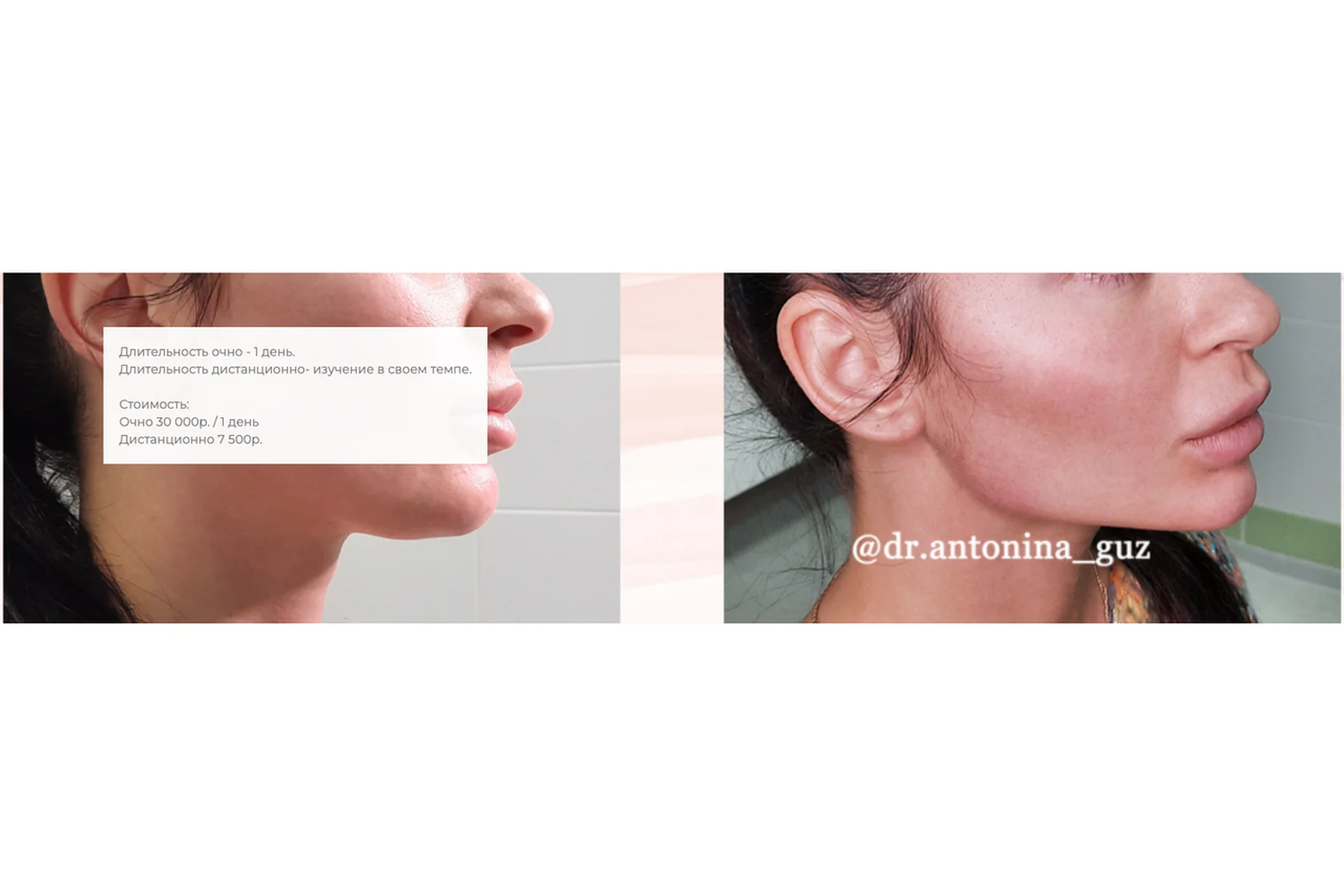 Профиль Джоли (Антонина Гуз), фото 1 из 1.