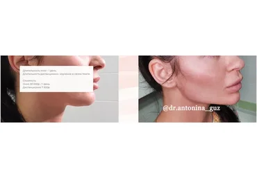 Профиль Джоли (Антонина Гуз)